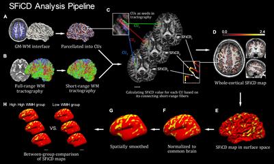 Cortical Short-Range Fiber Connectivity and Its Association With Deep Brain White Matter Hyperintensities in Older Diabetic People With Low Serum Vitamin B12